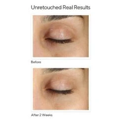 Murad Vita-C Eyes Dark Circle Corrector (Environmental Shield) (0.5 Fl Oz / 15 Ml ) -PureVita Store 15269 BA