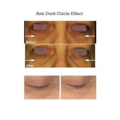 AminoGenesis EYE Control Eyelid Lifting & Dark Circle Serum (1.5 Fl Oz / 44 Ml) -PureVita Store AGSV190406 BA2