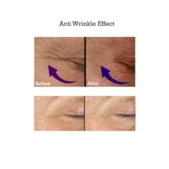 AminoGenesis EYE Control Eyelid Lifting & Dark Circle Serum (1.5 Fl Oz / 44 Ml) -PureVita Store AGSV190406 BA3