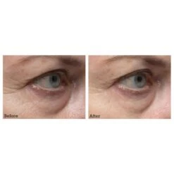 ELEMIS Pro-Collagen Eye Revive Mask [Limited Edition] (30 Ml) -PureVita Store EMSV190966 BA 1