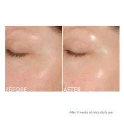 Exuviance Daily Resurfacing Peel CA10 (36 Pads) -PureVita Store EXUDANTIPL10 BA