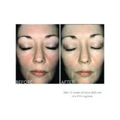 Exuviance Overnight Transformation Complex (Formerly Evening Restorative Complex) (50 G / 1.75 Oz) -PureVita Store EXVRESCMPX BA