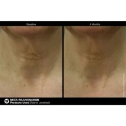 Jan Marini Marini Juveneck Neck Cream (57 G / 2 Oz) -PureVita Store MARV139501 BA2