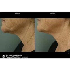 Jan Marini Marini Juveneck Neck Cream (57 G / 2 Oz) -PureVita Store MARV139501 BA3