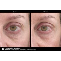 Jan Marini Marini Luminate Eye Gel (0.5 Fl Oz / 15 Ml) -PureVita Store MARV140327 BA1