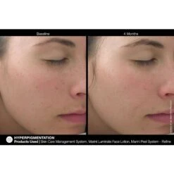 Jan Marini Marini Luminate Face Lotion (1.0 Fl Oz / 30 Ml) -PureVita Store MARV142363 BA1