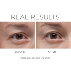 CosMedix Opti Crystal Liquid Crystal Eye Serum (0.25 Oz / 7 G) -PureVita Store MEDV142287 BA 1