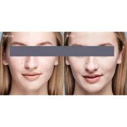 Murad Outsmart Acne Clarifying Treatment (Acne Control) (1.7 Fl Oz / 50 Ml) -PureVita Store MURV187326 BA1