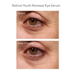 Murad Youth Renewal Retinol Trial Kit (Resurgence) [$98 Value] (set) -PureVita Store MURV190015 BA1