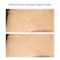 Murad Youth Renewal Retinol Trial Kit (Resurgence) [$98 Value] (set) -PureVita Store MURV190015 BA2