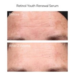Murad Youth Renewal Retinol Trial Kit (Resurgence) [$98 Value] (set) -PureVita Store MURV190015 BA3