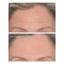 Murad Targeted Wrinkle Corrector (0.5 Fl Oz / 15 Ml) -PureVita Store MURV190793 BA1