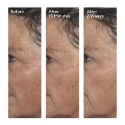 Murad Targeted Wrinkle Corrector (0.5 Fl Oz / 15 Ml) -PureVita Store MURV190793 BA2