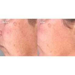 Murad Correct & Protect Serum Broad Spectrum SPF 45 | PA++++ (1 Fl Oz / 30 Ml) -PureVita Store MURV190797 BA2