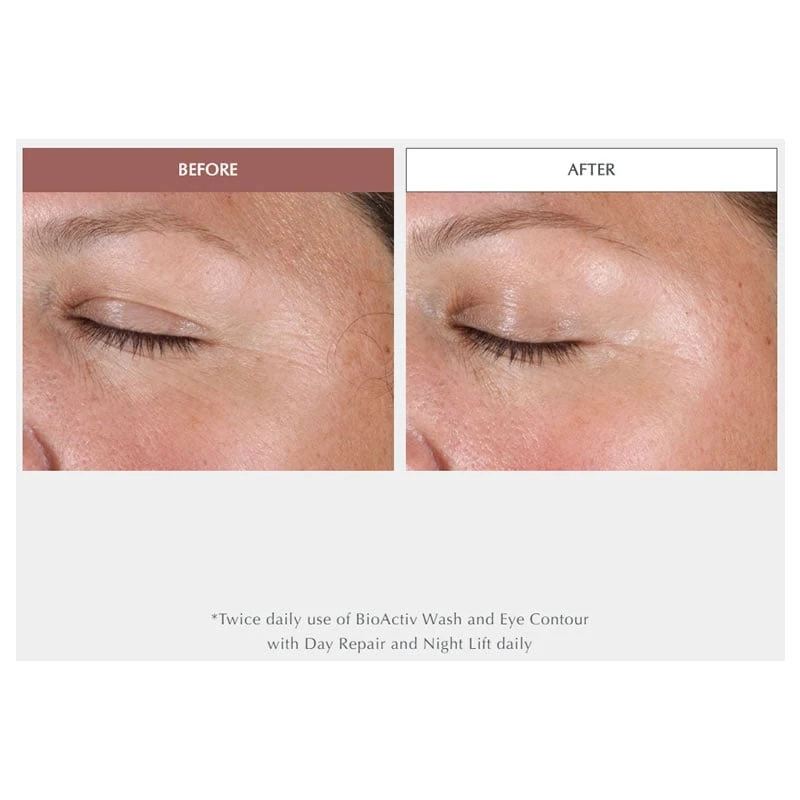 Exuviance Age Reverse Eye Contour (15 G / 0.5 Oz) 5 Exuviance Age Reverse Eye Contour (15 G / 0.5 Oz) - Image 3