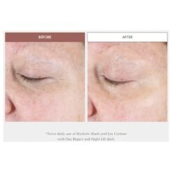 Exuviance Age Reverse Eye Contour (15 G / 0.5 Oz) 9 Exuviance Age Reverse Eye Contour (15 G / 0.5 Oz) -PureVita Store NSTAREYE BA2