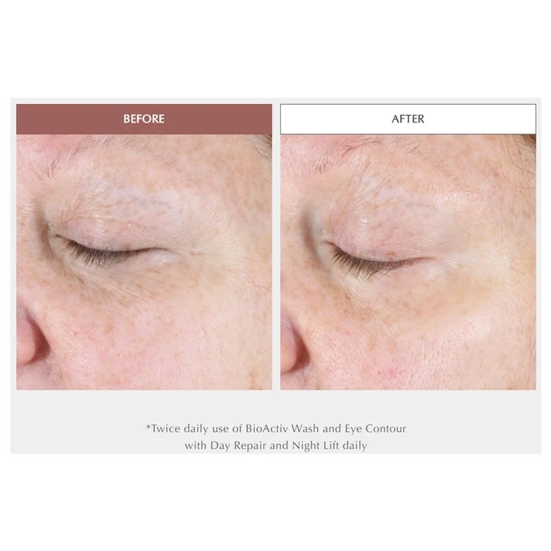 Exuviance Age Reverse Eye Contour (15 G / 0.5 Oz) 6 Exuviance Age Reverse Eye Contour (15 G / 0.5 Oz) - Image 4