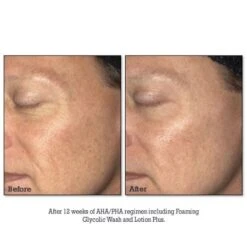 NEOSTRATA Lotion Plus (RESURFACE) (200 Ml / 6.8 Fl Oz) 9 NEOSTRATA Lotion Plus (RESURFACE) (200 Ml / 6.8 Fl Oz) -PureVita Store NSTDBLLP15 BA2