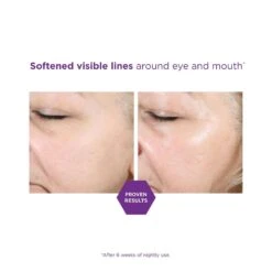 NEOSTRATA Comprehensive Retinol Eye Cream (Correct) (15 Ml / 0.5 Fl Oz) -PureVita Store NSTV190860 BA 1