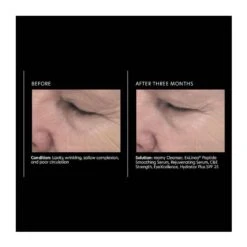 PCA Skin ExLinea Peptide Smoothing Serum (1.0 Fl Oz / 29.5 Ml) -PureVita Store PCAV128043 BA1