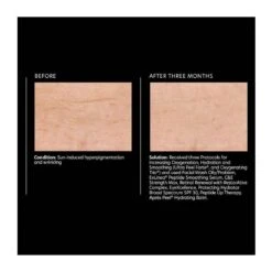 PCA Skin ExLinea Peptide Smoothing Serum (1.0 Fl Oz / 29.5 Ml) -PureVita Store PCAV128043 BA2