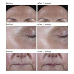 PCA Skin Exlinea Pro Peptide Serum (1.0 Fl Oz / 30 Ml) -PureVita Store PCAV190392 BA