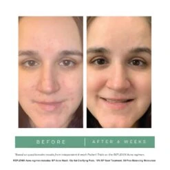 REPLENIX Gly-Sal 10-2 Clarifying Pads (formerly Known As REPLENIX Gly/Sal 10-2 Pads) (60 Pads) -PureVita Store Replenix AcneRegimen BA 3