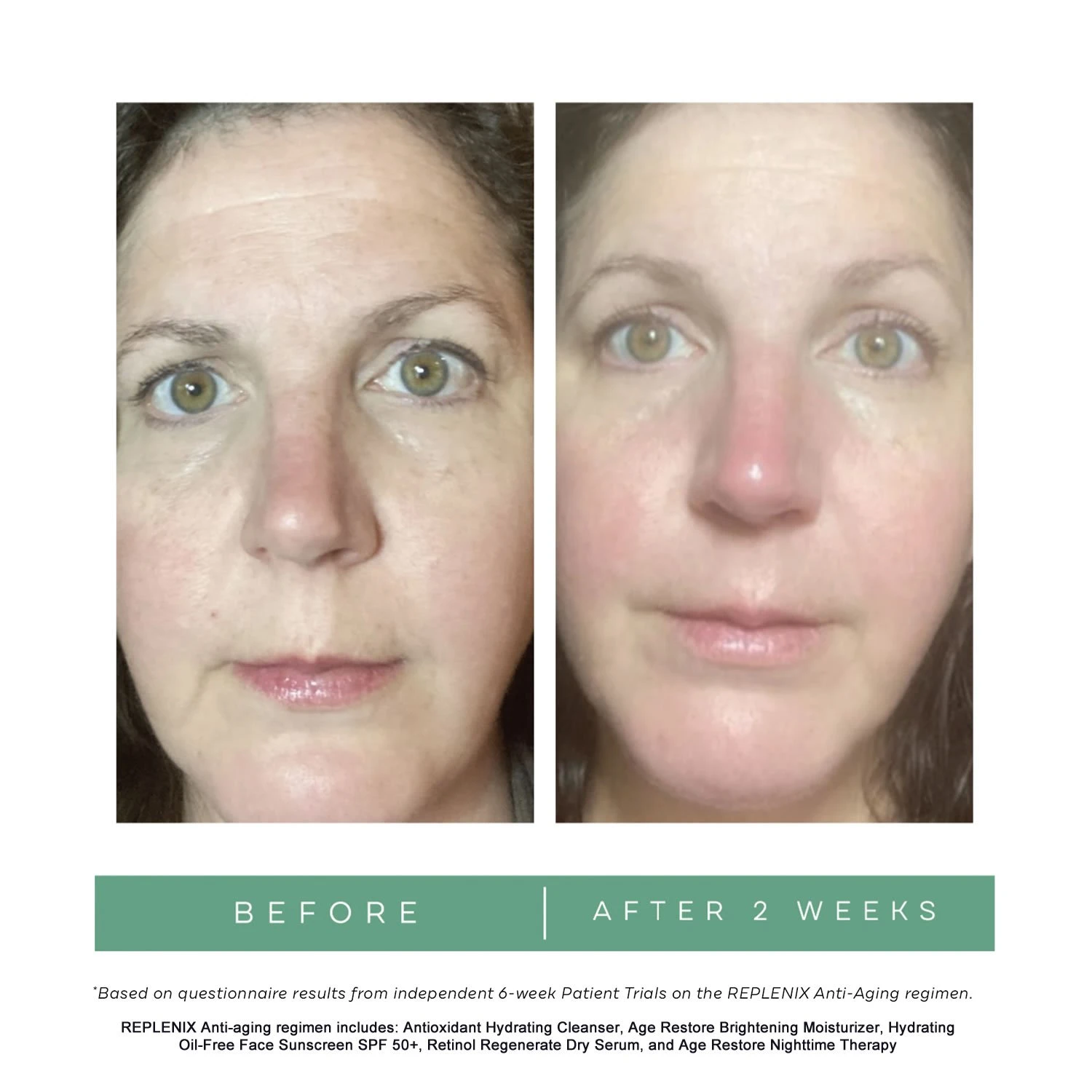 REPLENIX Retinol 2x Regenerate Dry Serum (formerly Known As REPLENIX RetinolForte Treatment Serum 2X) (1.0 Fl Oz / 30 Ml) 7 REPLENIX Retinol 2x Regenerate Dry Serum (formerly Known As REPLENIX RetinolForte Treatment Serum 2X) (1.0 Fl Oz / 30 Ml) - Image 5