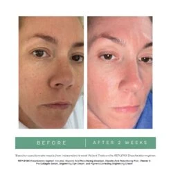 REPLENIX Brightening Eye Cream (formerly Known As REPLENIX All-trans-Retinol Enriched Eye Repair Cream) (0.5 Oz / 14 G) -PureVita Store Replenix DiscolorationRegimen BA 1