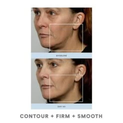 NuFACE Trinity Facial Toning Device (set) 9 NuFACE Trinity Facial Toning Device (set) -PureVita Store nfcv140668 p BA1 1