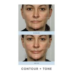 NuFACE Trinity Facial Toning Device (set) 10 NuFACE Trinity Facial Toning Device (set) -PureVita Store nfcv140668 p BA2 1