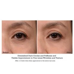 NeoStrata Brightening Eye Cream (ENLIGHTEN) (15 G / 0.5 Oz) -PureVita Store nstgorbec4 BA1 1