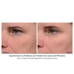 NeoStrata Brightening Eye Cream (ENLIGHTEN) (15 G / 0.5 Oz) 9 NeoStrata Brightening Eye Cream (ENLIGHTEN) (15 G / 0.5 Oz) -PureVita Store nstgorbec4 BA2 2