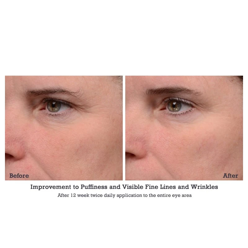 NeoStrata Brightening Eye Cream (ENLIGHTEN) (15 G / 0.5 Oz) 6 NeoStrata Brightening Eye Cream (ENLIGHTEN) (15 G / 0.5 Oz) - Image 4