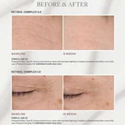 SkinMedica Retinol Complex 1.0 (29.6 Ml / 1 Fl Oz) (Age Defense) -PureVita Store skm10rtnlcmpl BA