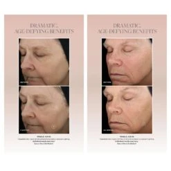 SkinMedica TNS Advanced+ Serum (1 Oz / 28.4 G) 10 SkinMedica TNS Advanced+ Serum (1 Oz / 28.4 G) -PureVita Store skmv189554 BA