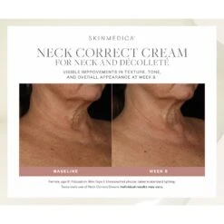 SkinMedica Neck Correct Cream (2 Oz / 56.7 G) 14 SkinMedica Neck Correct Cream (2 Oz / 56.7 G) -PureVita Store skmv190036 BA1