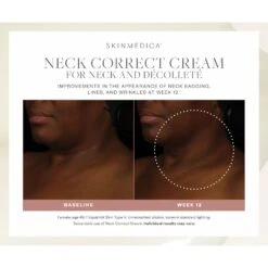 SkinMedica Neck Correct Cream (2 Oz / 56.7 G) 15 SkinMedica Neck Correct Cream (2 Oz / 56.7 G) -PureVita Store skmv190036 BA2