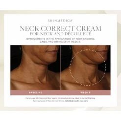 SkinMedica Neck Correct Cream (2 Oz / 56.7 G) 16 SkinMedica Neck Correct Cream (2 Oz / 56.7 G) -PureVita Store skmv190036 BA3