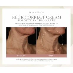 SkinMedica Neck Correct Cream (2 Oz / 56.7 G) 17 SkinMedica Neck Correct Cream (2 Oz / 56.7 G) -PureVita Store skmv190036 BA4
