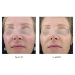 Vivier Radiance Serum (30 Ml / 1.0 Fl Oz) -PureVita Store vvsv139475 BA2